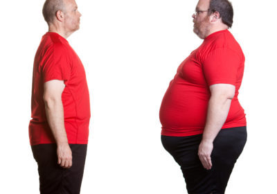 comprehensive-weight-loss-services-400x280-9658685